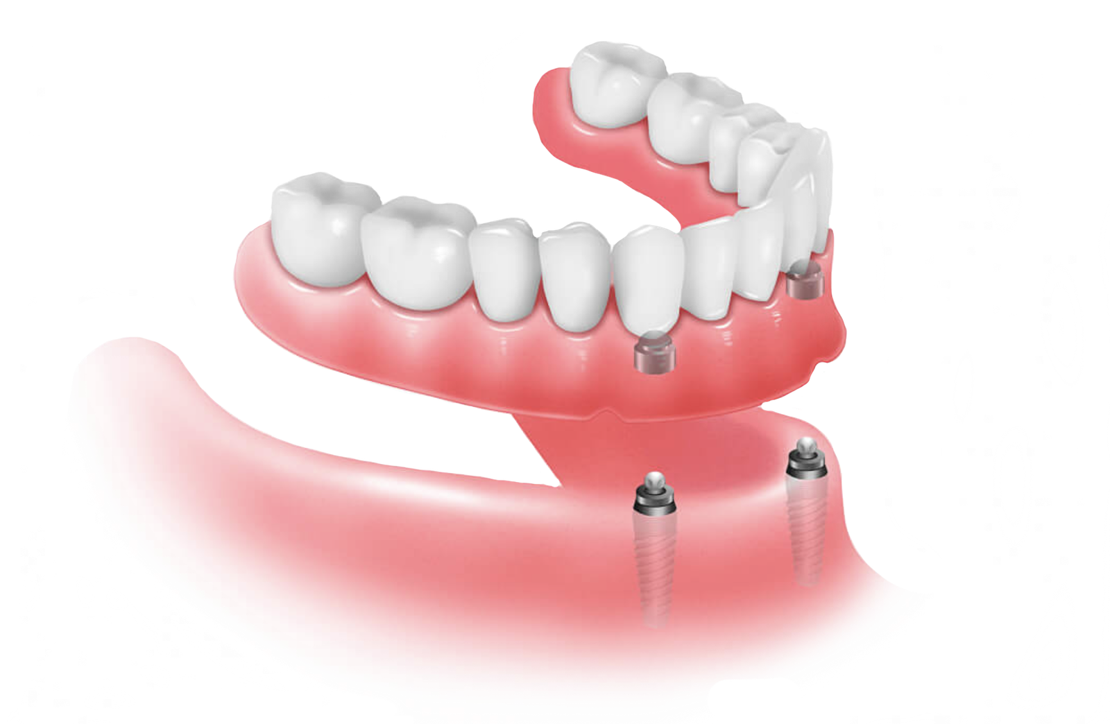 https://dentistofaventura.com/wp-content/uploads/2024/11/d.png