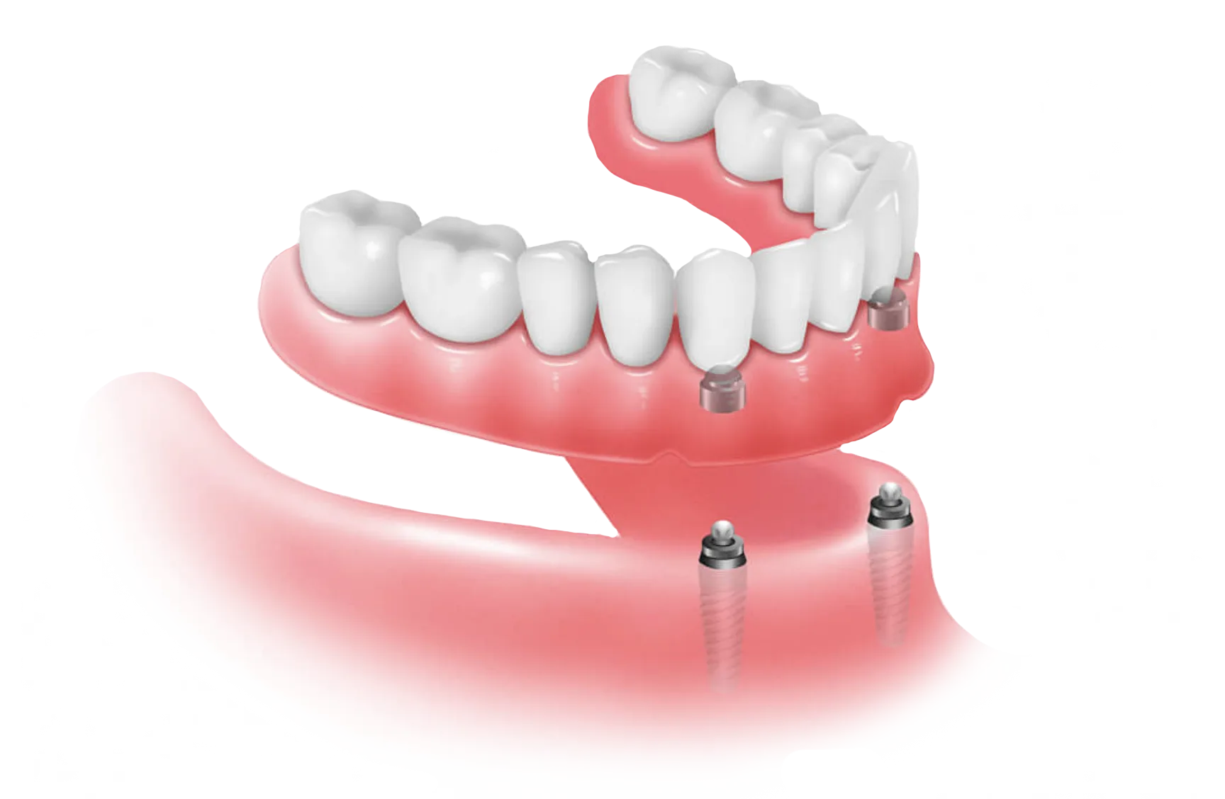 https://dentistofaventura.com/wp-content/uploads/2024/11/d.png