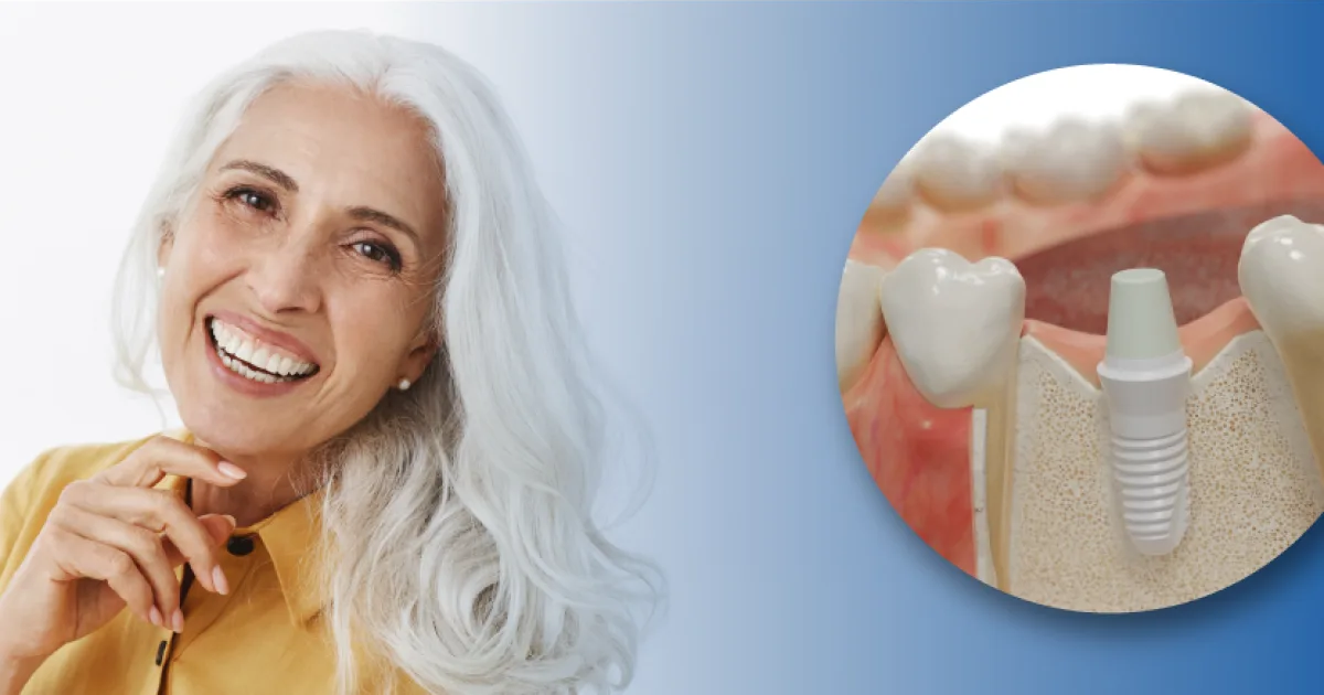 Holistic Dentistry and Zirconia Implants at Dentist of Aventura