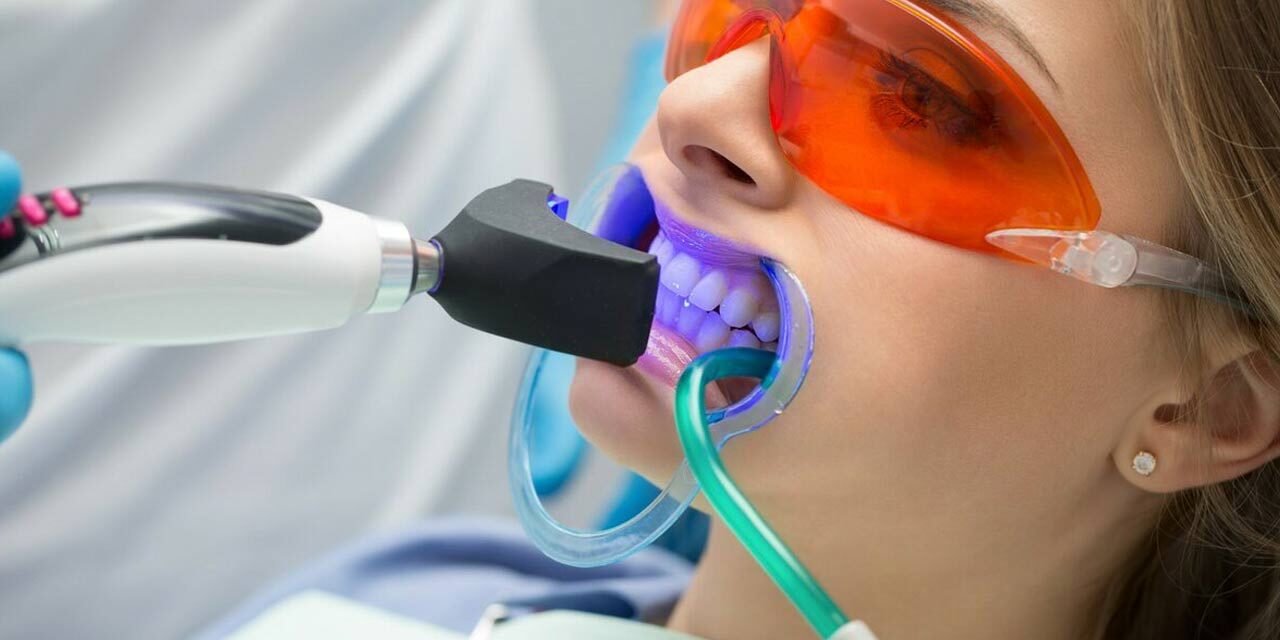 Professional Teeth Whitening in Aventura, FL