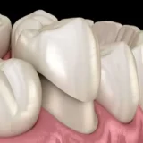 i 5