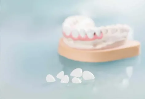 Porcelain Veneers in Aventura