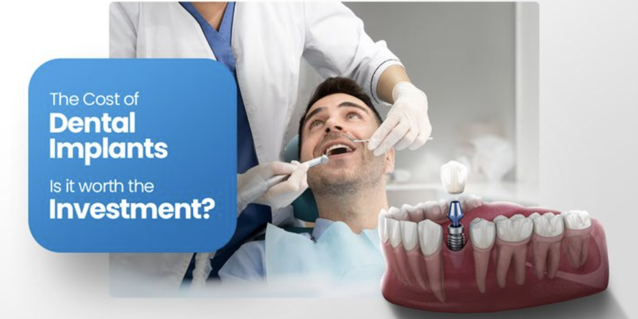 How Much Does a Dental Implant Really Cost in Aventura, FL? (2026 Honest Prices)